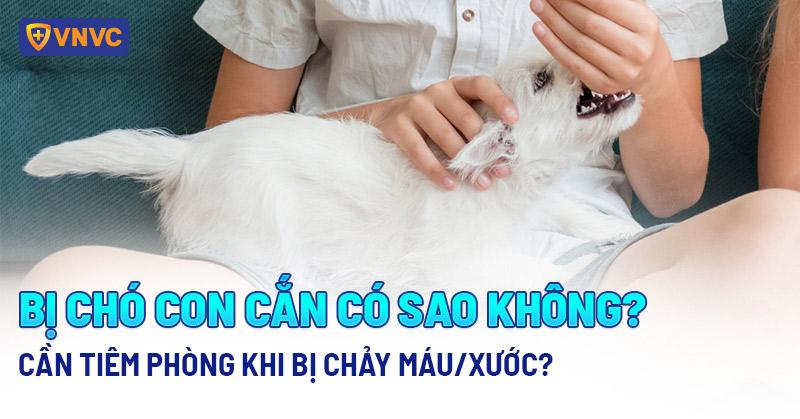 Bị chó con cắn có sao không? Cần tiêm phòng khi bị chảy máu/xước?