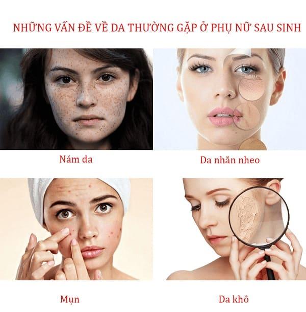 Top 11 loại Kem dưỡng trắng da mặt tốt nhất hiện nay