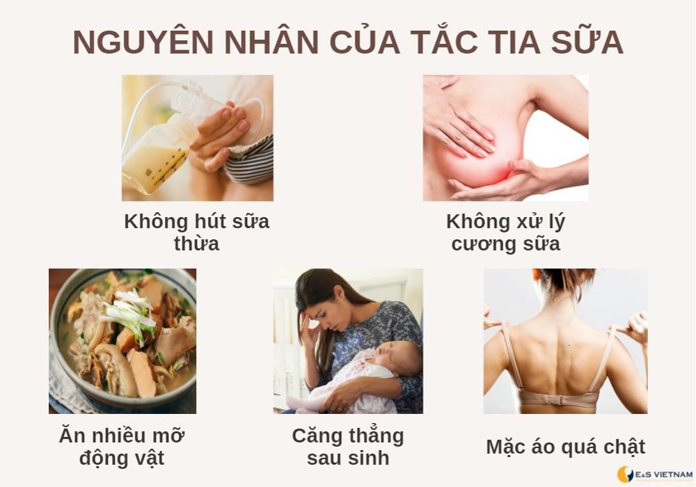 5 mẹo chữa tắc tia sữa chỉ trong phút chốc!