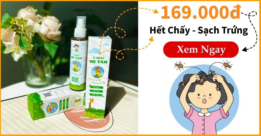 9 Cách Trị Chấy Tại Nhà Cho Người Lớn & Trẻ Em Nhanh Nhất