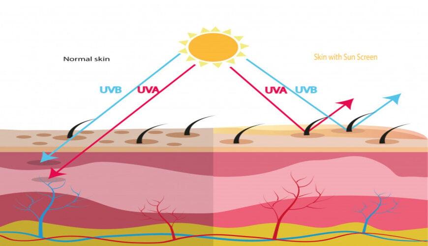 Da khô tróc vảy - Cách ngăn ngừa và chăm sóc hiệu quả