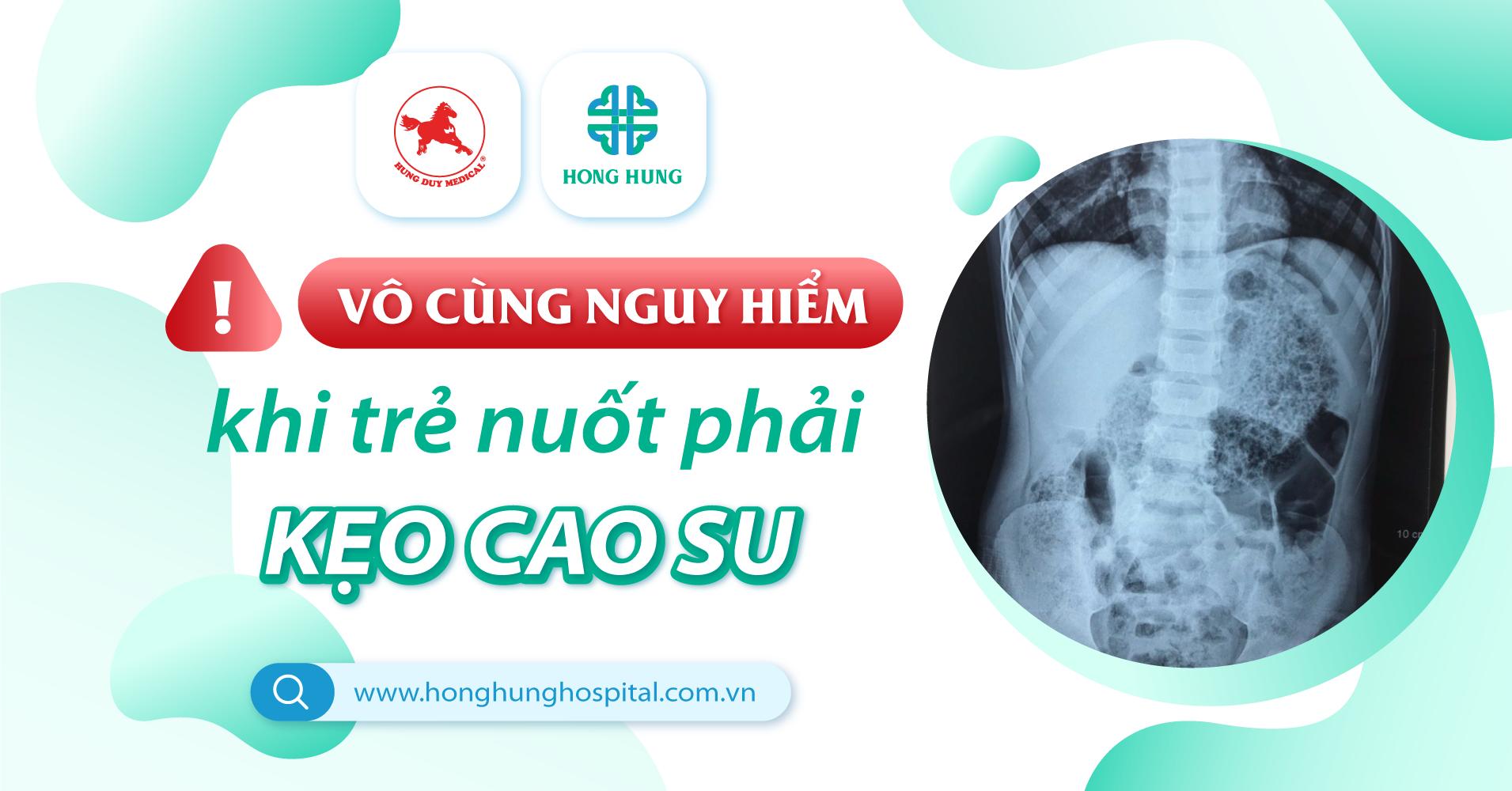 Cảnh giác: Trẻ nhỏ nuốt phải KẸO CAO SU & KEO THỔI BÓNG gây nguy hiểm tính mạng