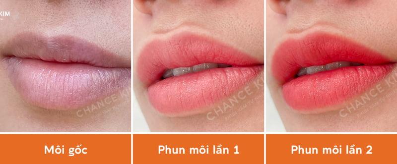 6 điều PHẢI BIẾT khi phun môi lần 2 để tránh tiền mất tật mang