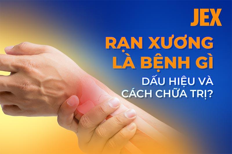 Rạn xương: Nguyên nhân, dấu hiệu và cách cải thiện