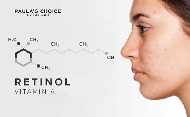 Phân biệt Tretinoin và Retinol khác nhau như thế nào?