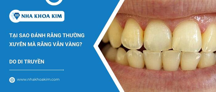 Tại sao đánh răng thường xuyên mà răng vẫn vàng?