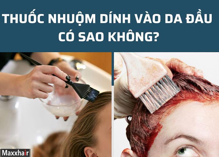 Thuốc nhuộm dính vào da đầu có sao không? Cần cẩn thận khi dùng thuốc nhuộm tóc