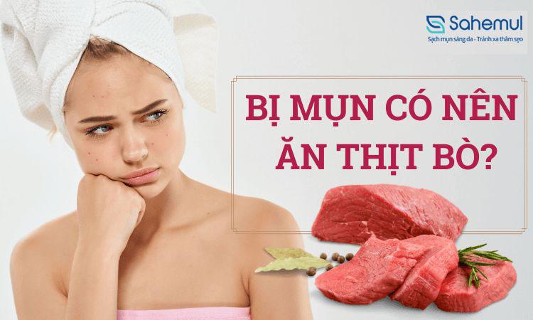 Bị mụn có nên ăn thịt bò không? Nên làm gì khi bị mụn?