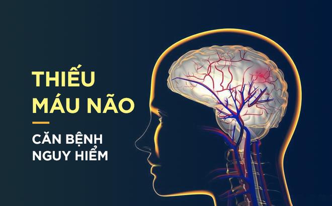 6 MẸO GIÚP LƯU THÔNG MÁU LÊN NÃO