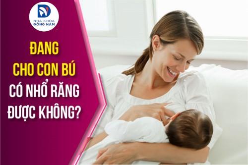 Đang Cho Con Bú Có Nhổ Răng Được Không?