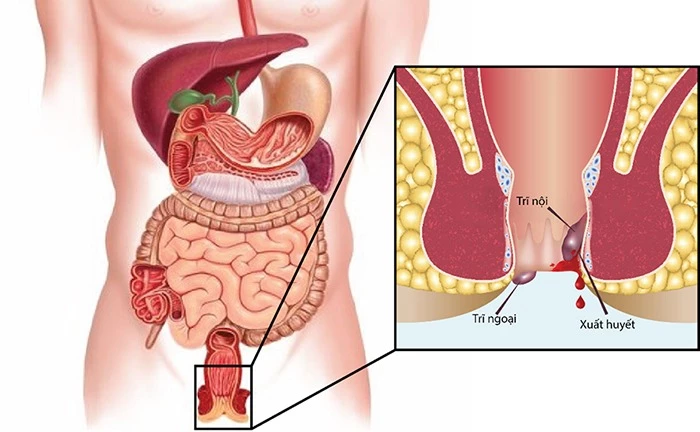 10 tác dụng của rau diếp cá có thể bạn chưa biết