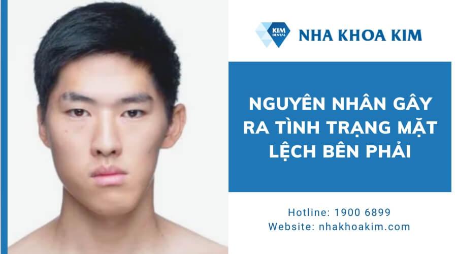 Mặt lệch bên phải thì nhai và nằm nghiêng bên nào?