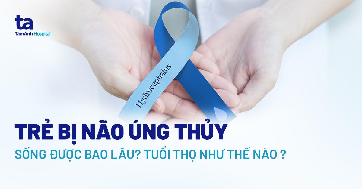 Trẻ bị não úng thủy sống được bao lâu? Tuổi thọ như thế nào?