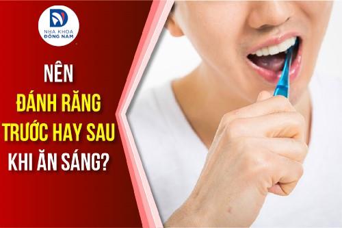 [Tranh Cãi] Nên Đánh Răng Trước Hay Sau Khi Ăn Sáng?