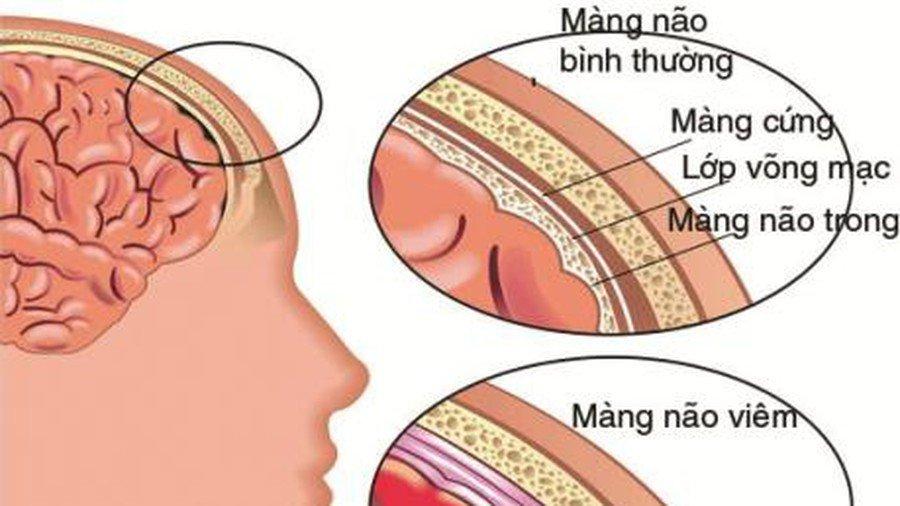 Những điều cần biết về bệnh dại