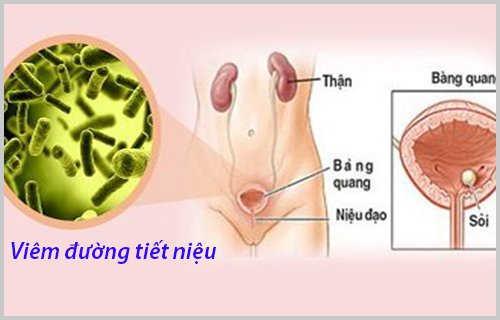 Nước tiểu màu vàng sáng khi mang thai có đáng lo ngại?