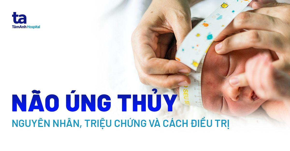 Não úng thủy: Nguyên nhân, triệu chứng và cách điều trị