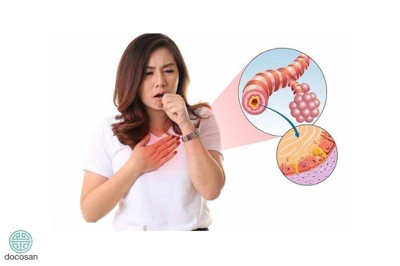 Bệnh Viêm Phế Quản Cấp J20: Bệnh gì, Nguyên nhân, Dấu hiệu?