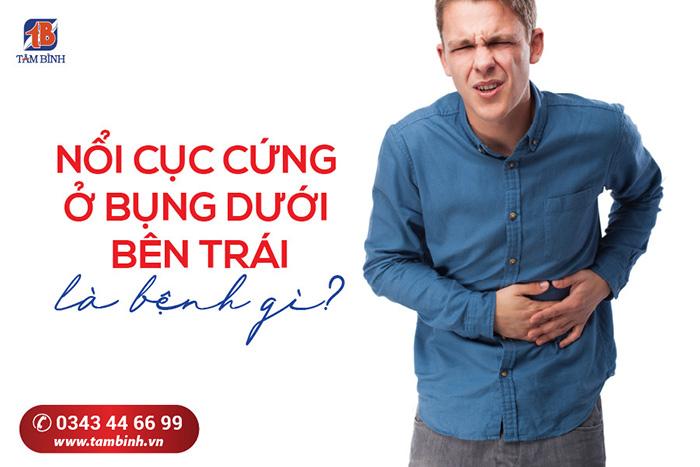 Nổi cục cứng ở bụng dưới bên trái là bệnh gì?