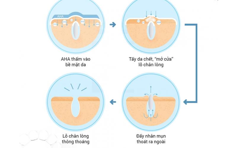 Mách bạn cách sử dụng AHA đúng chuẩn