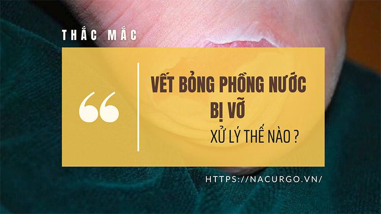 Vết bỏng phồng rộp nước bị vỡ xử lý thế nào? [Góc tư vấn]