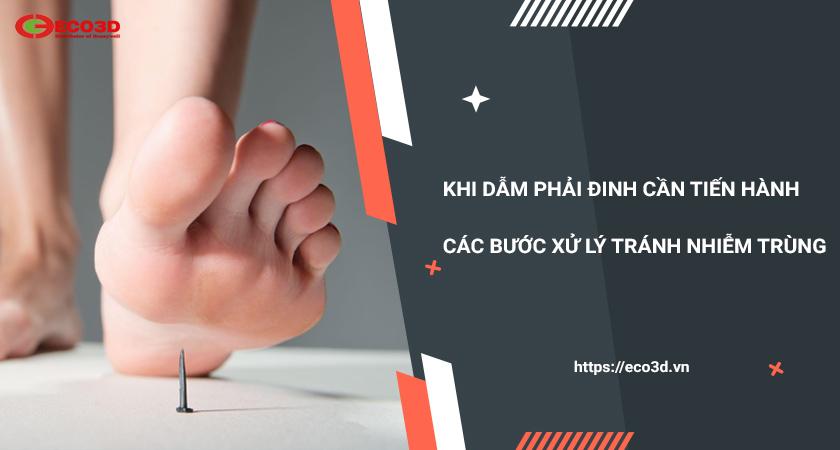 Dẫm phải đinh cần xử lý thế nào?