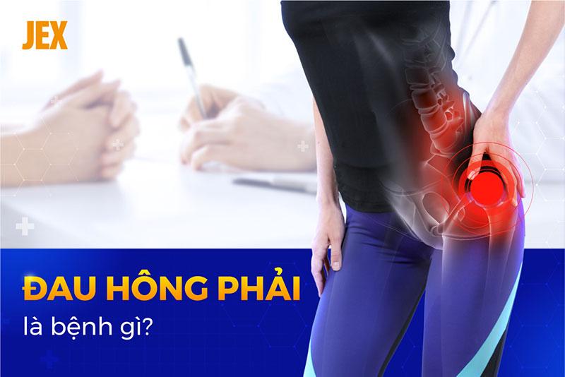 Đau hông phải là bệnh gì? 11 nguyên nhân, dấu hiệu thường gặp