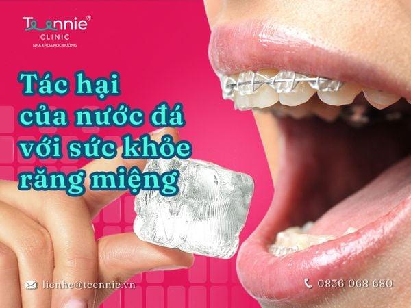 Góc giải đáp niềng răng có được uống nước đá không?