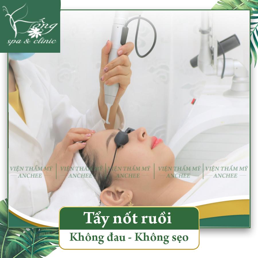 [Xem Bói] Nốt Ruồi ở Xương Quai Xanh – Trái , Phải Tốt hay Xấu ? [2024]