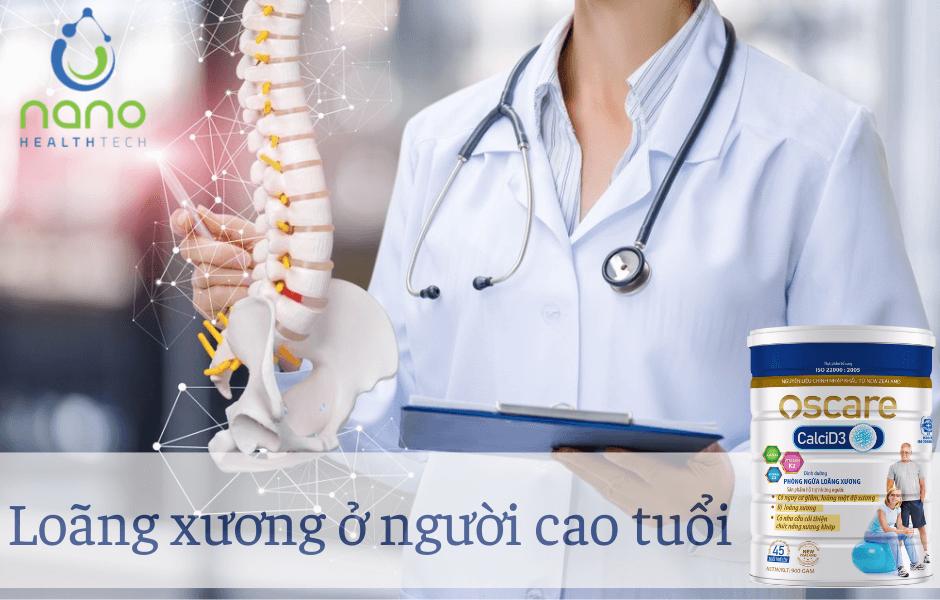 TOP 6 loại sữa xương khớp cho người trung niên tốt nhất