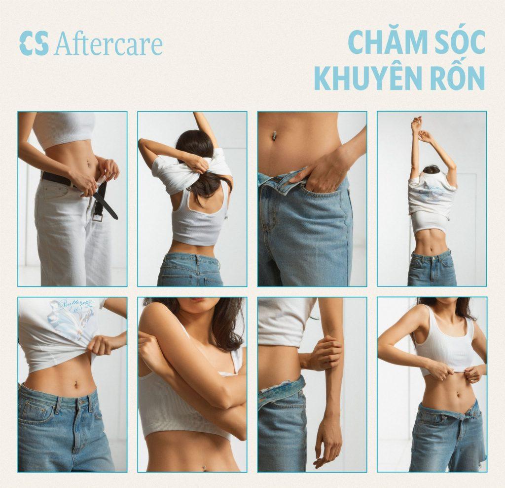 CHĂM SÓC HẬU XỎ KHUYÊN RỐN