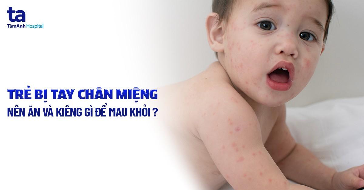 Trẻ bị tay chân miệng kiêng gì và nên ăn gì để mau khỏi bệnh?