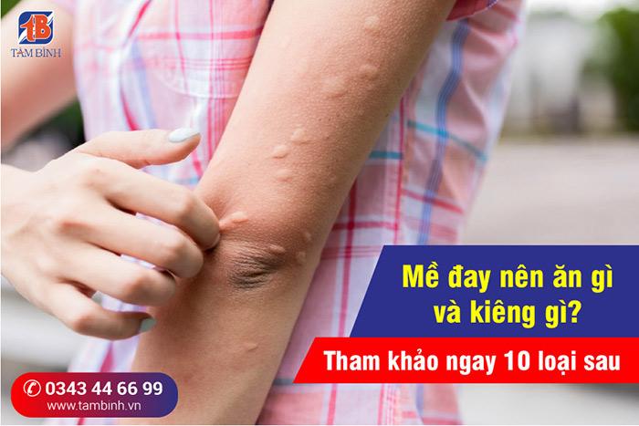 Nổi mề đay nên ăn gì và kiêng gì? Tham khảo ngay 10 loại sau