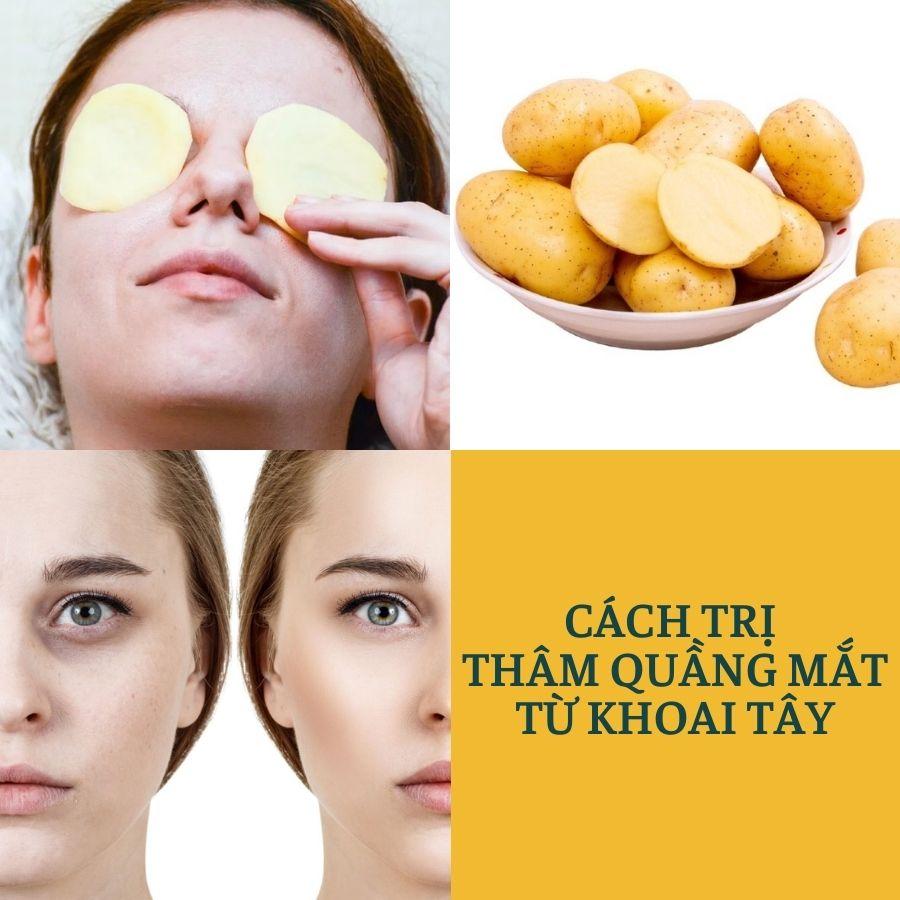 Bất ngờ với 4 cách trị thâm mắt bằng khoai tây