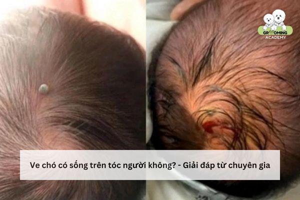 Ve chó có sống trên tóc người được không? – [A-Z] Thông tin bạn cần biết