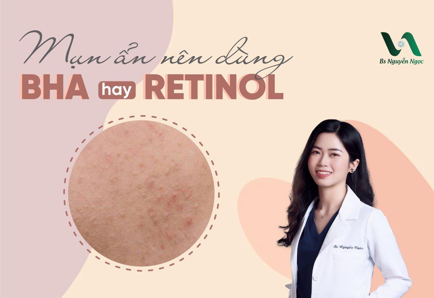 Mụn ẩn nên dùng BHA hay Retinol?