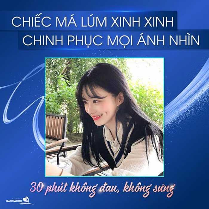 Tạo Má Lúm Đồng Tiền Giá Bao Nhiêu?