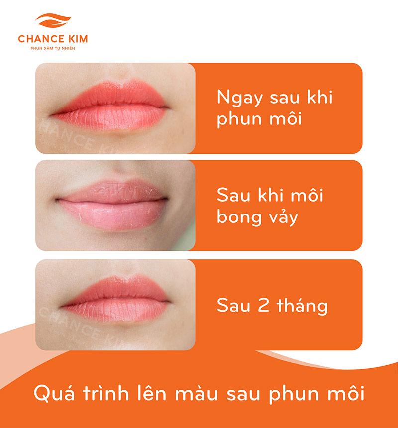 Phun môi collagen bao lâu thì lên màu?