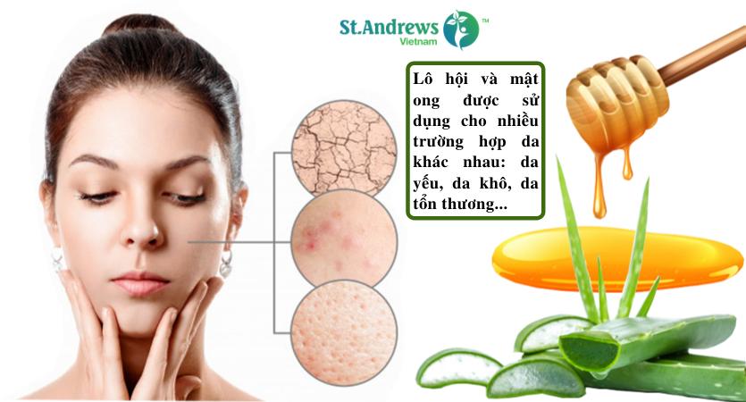 Lô Hội Và Mật Ong: 11 Tác Dụng Tuyệt Vời Không Thể Bỏ Qua